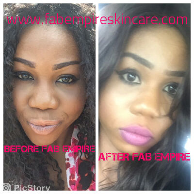 Fab Empire Skincare » Face Cream Treatment