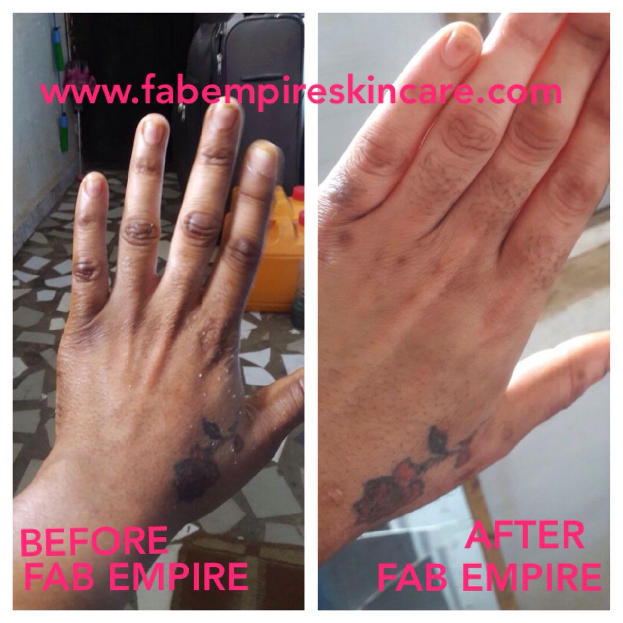 Fabempireskincare Â» Peeling oil + dark knuckle oil treatment